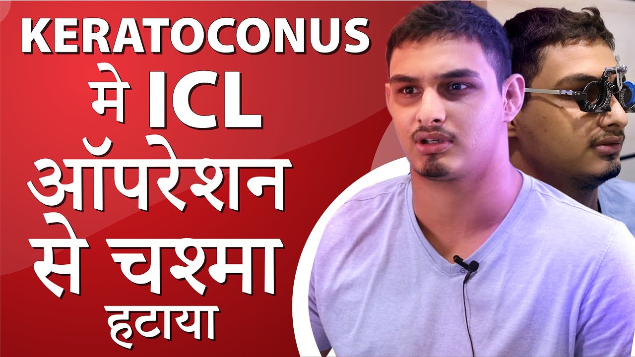 कैरेटोकोनस मे  ICL सर्जरी से चश्मा हटाया | C3R + ICL surgery | Specs Removal in Keratoconus