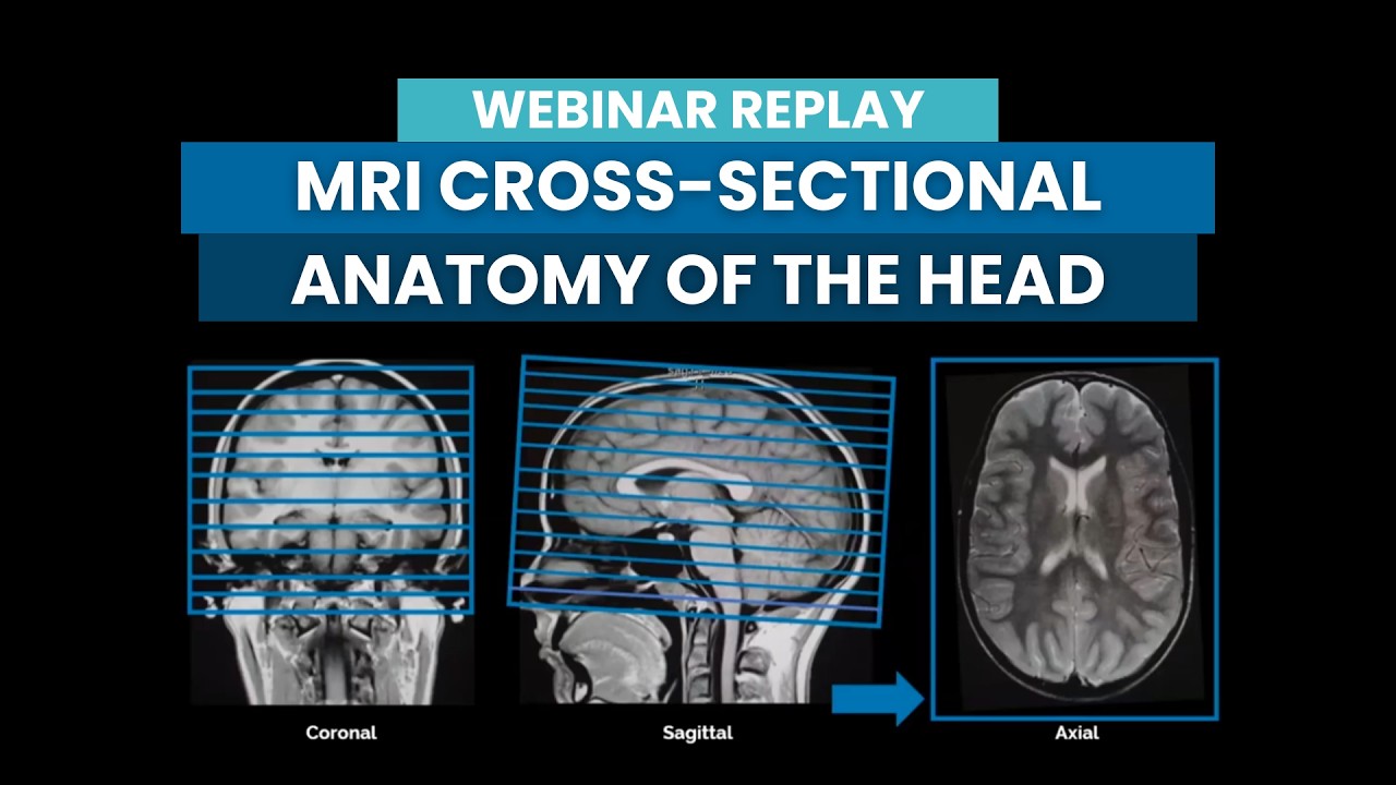 MRI Cross Sectional Anatomy of the Head Webinar Replay