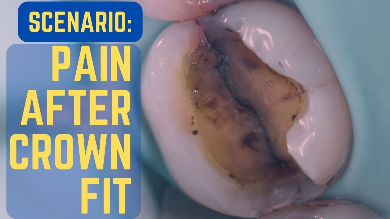 Pain after Crown Fit - an Upset Patient! How to Manage Tough Scenarios - PDP167