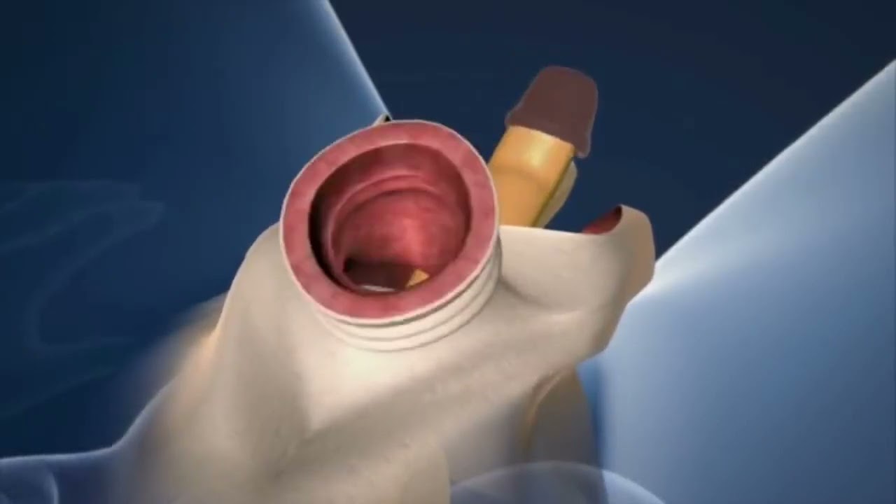 The Imperfect Man - Male to Female surgical transformation 3D Animation (Season5 Ep27)