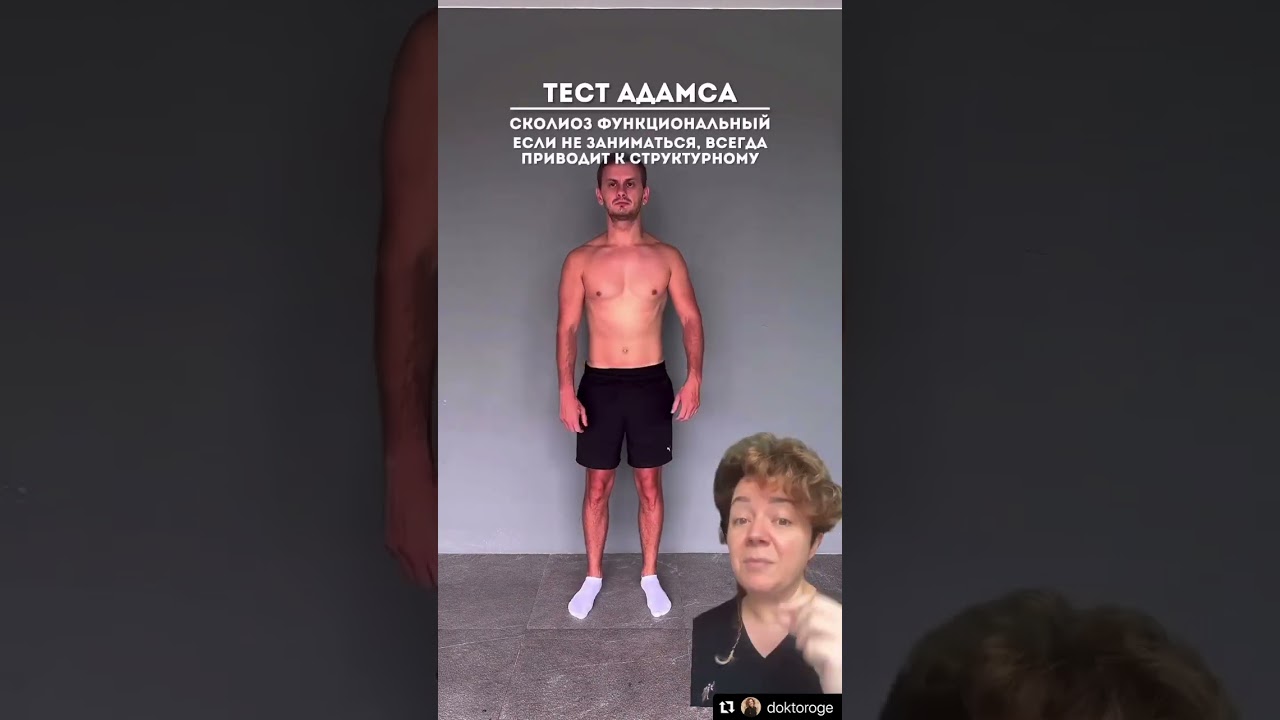 ⚠️Skolyozu nasıl anlarsınız? #çocuk #çocuksağlığı #ankaraçocukdoktoru #skolyoz