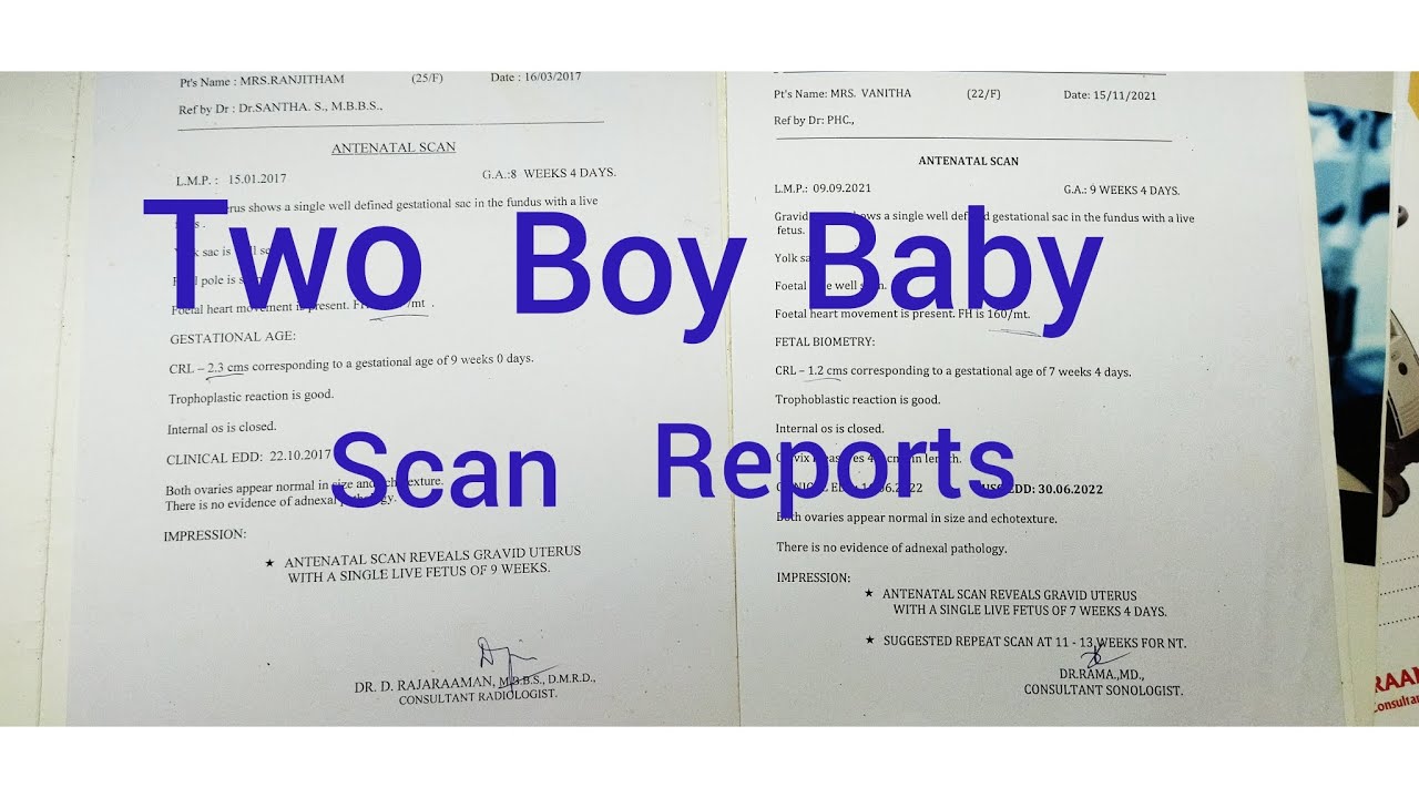 Two Boy Baby Full ScanRepors and major difference & placenta, Fhr and gender prediction in tamil