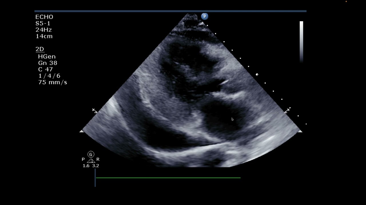 Advanced Echo Vid