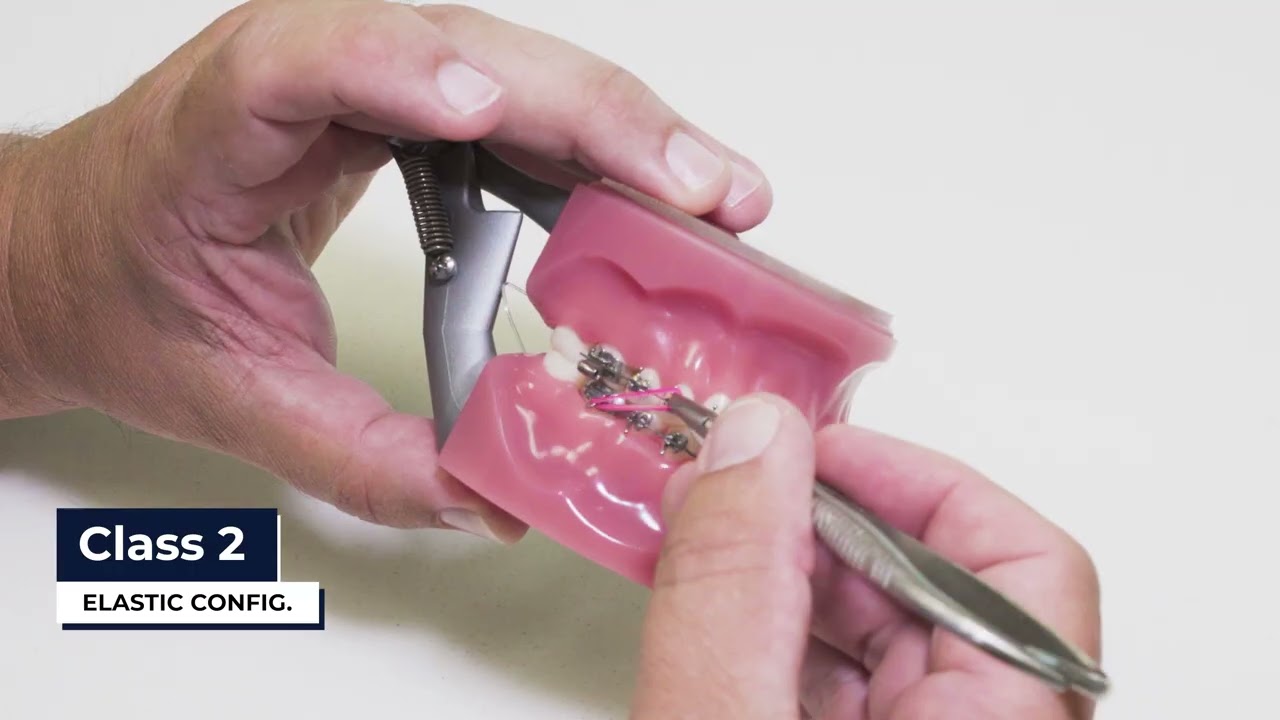 Class 2 Rubber Bands: How to Wear Them (Orthodontist Dr. Andy Bennion Explains)