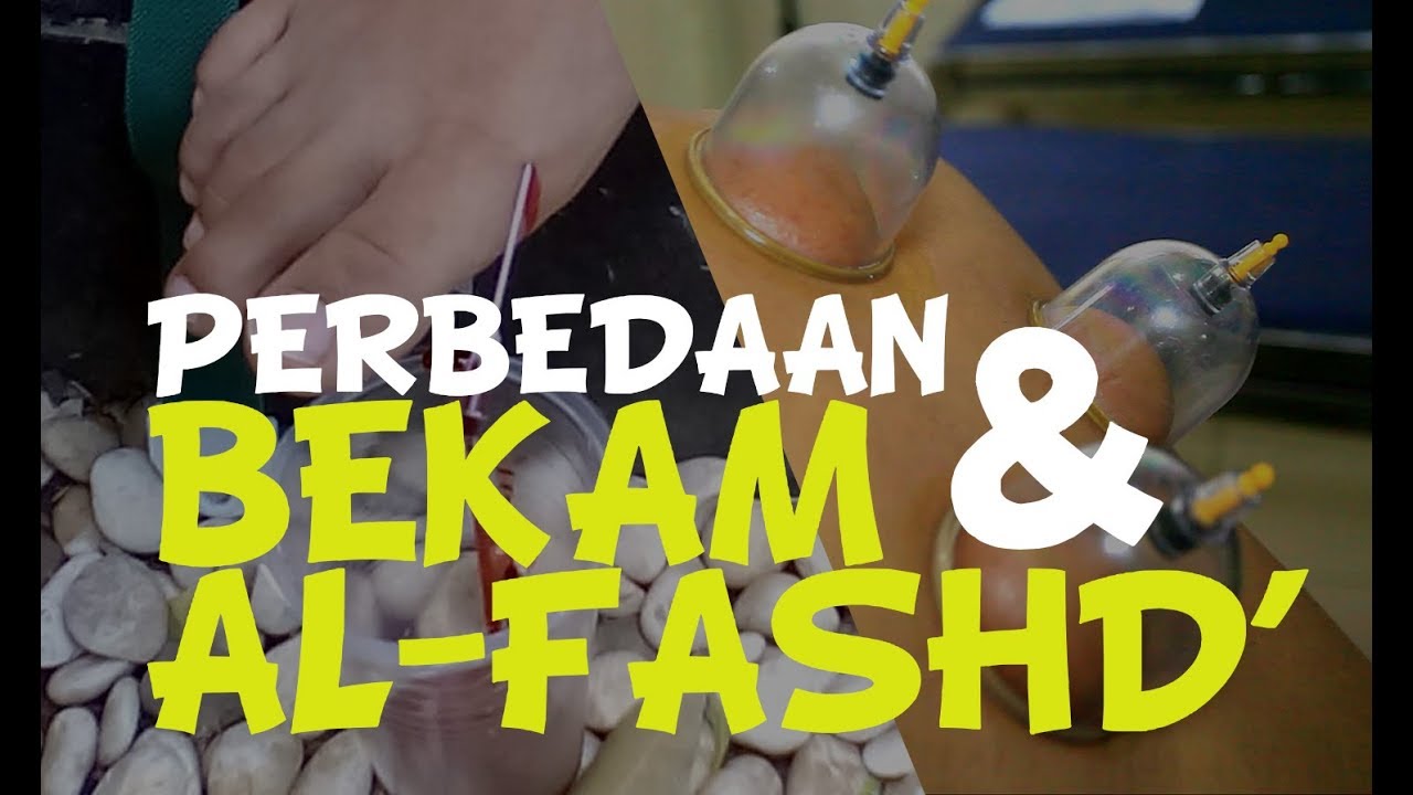 Perbedaan Bekam dan Al-Fashd' ?
