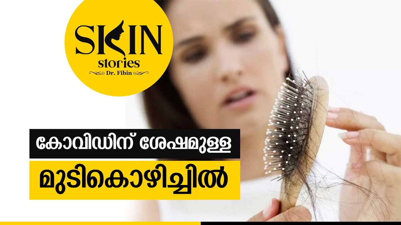 കോവിഡിന് ശേഷമുള്ള മുടികൊഴിച്ചിൽ | Post Covid Hair loss Treatment | Dr. Fibin | Skin Stories #26