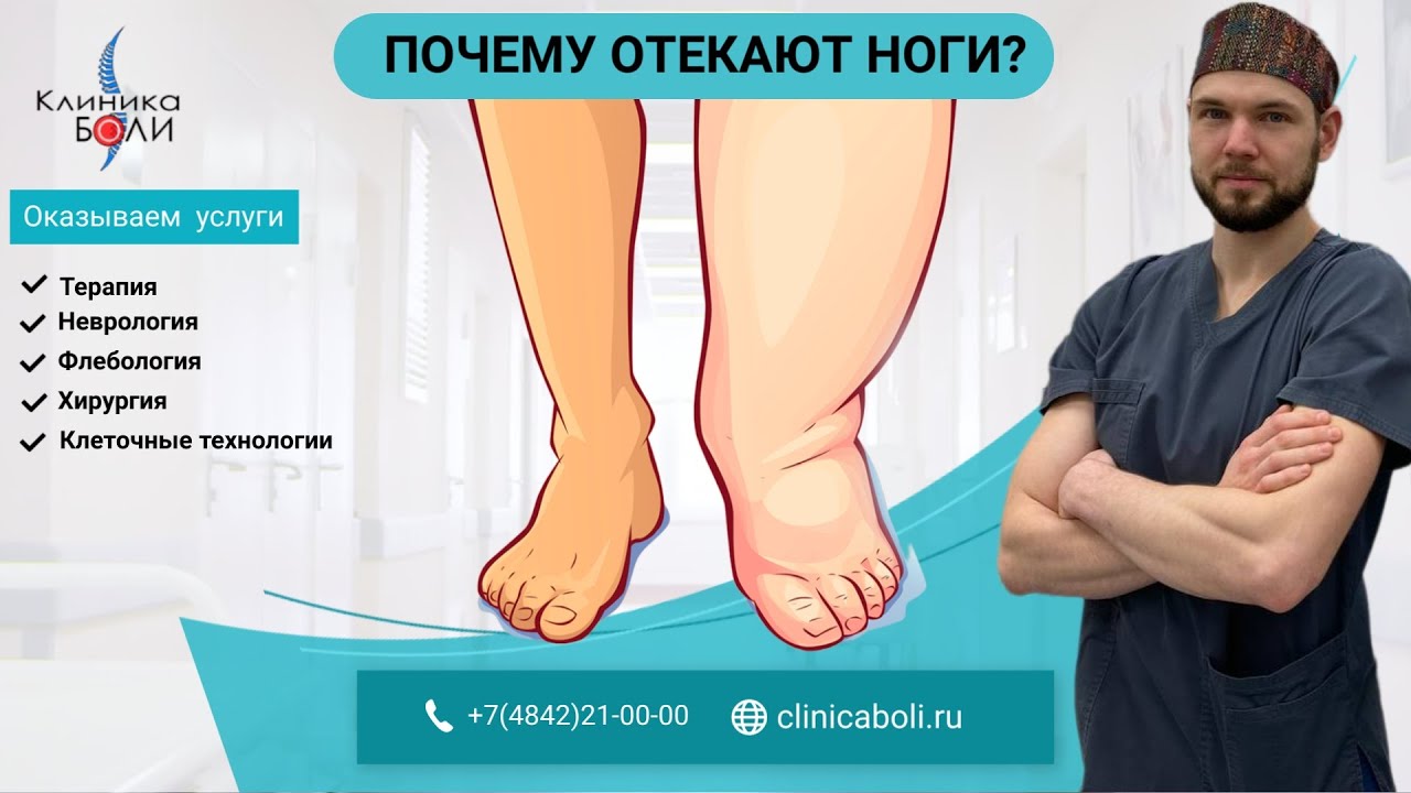 ПОЧЕМУ ОТЕКАЮТ НОГИ?