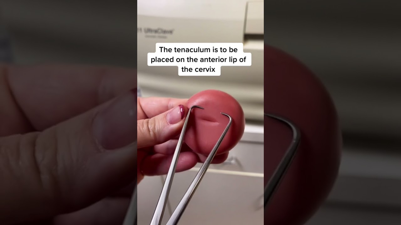 IUD insertion