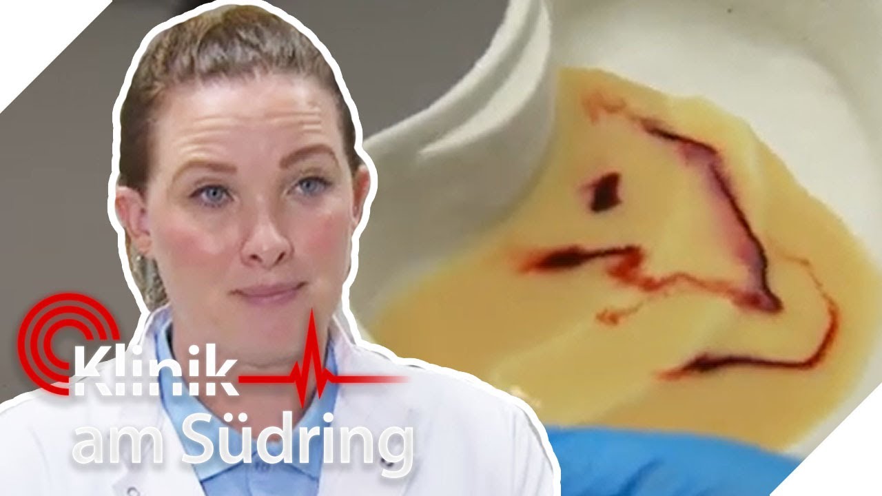 Frisches Blut im Erbrochenen! Charlotte muss schnell handeln! | Klinik am Südring | SAT.1