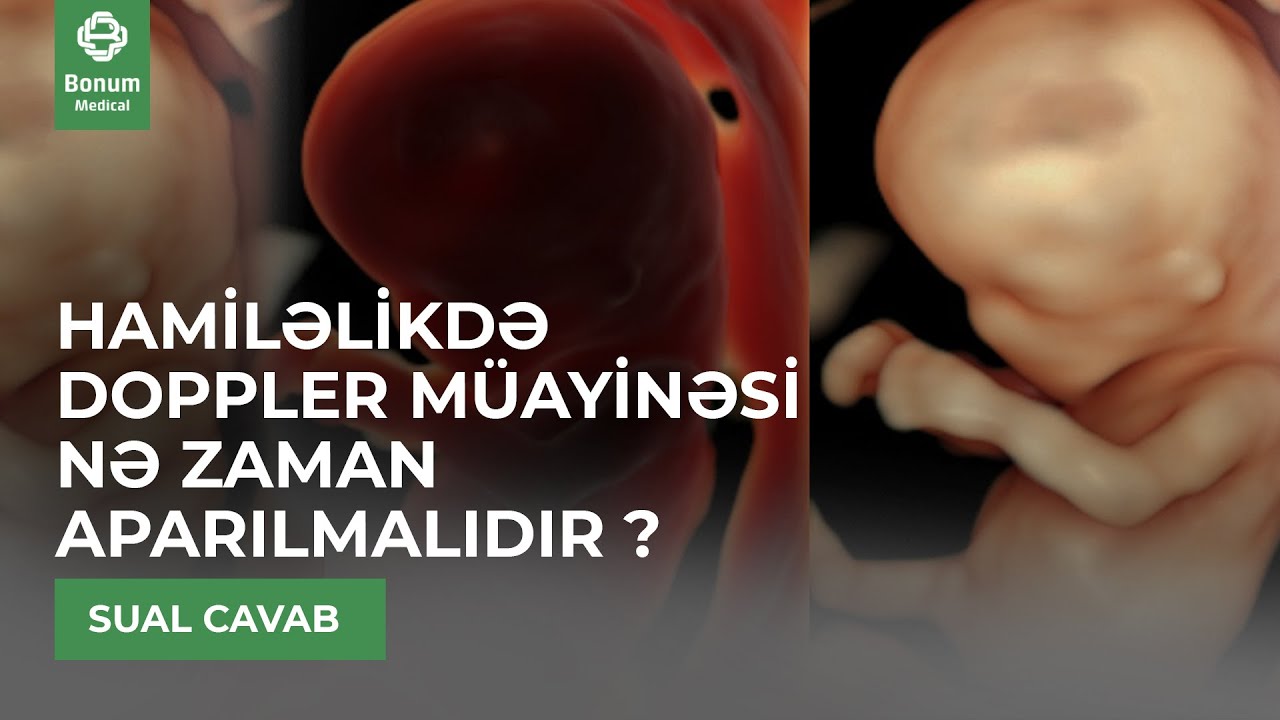 Hamiləlikdə DOPPLER MÜAYİNƏSİ NƏ ZAMAN APARILMALIDIR ? #bonummedical