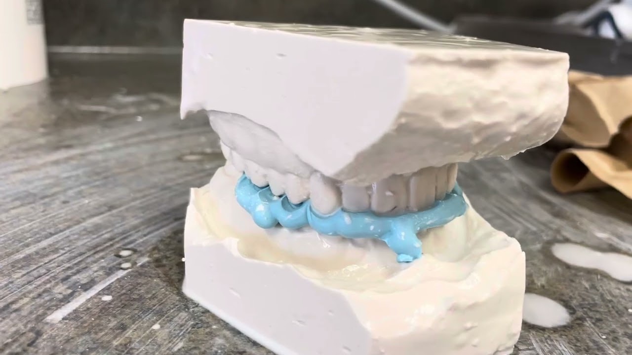 Trim a Study Model