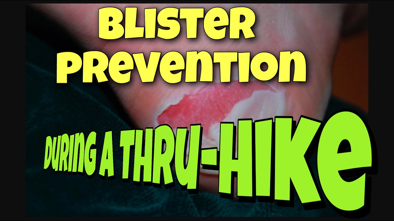 Предотвращение появления мозолей во время похода по тропам