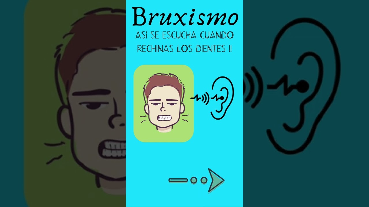 Maxilofacial Saltillo. Bruxismo y Apretamiento Dental