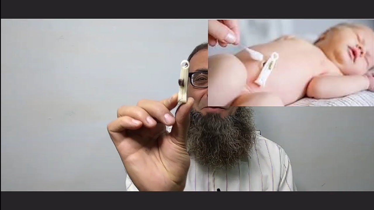 كتب الكتاب آخر الشهر وسرة الطفل من الأفعال الخطأ