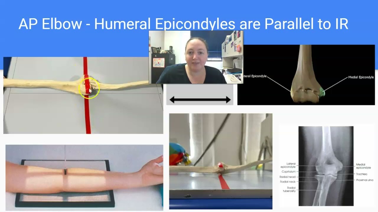 Parallel vs. Perpendicular Radiology Imaging