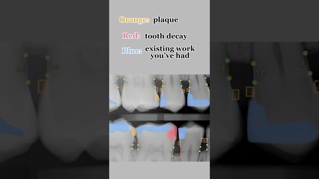 AI Dental Technology  #shorts