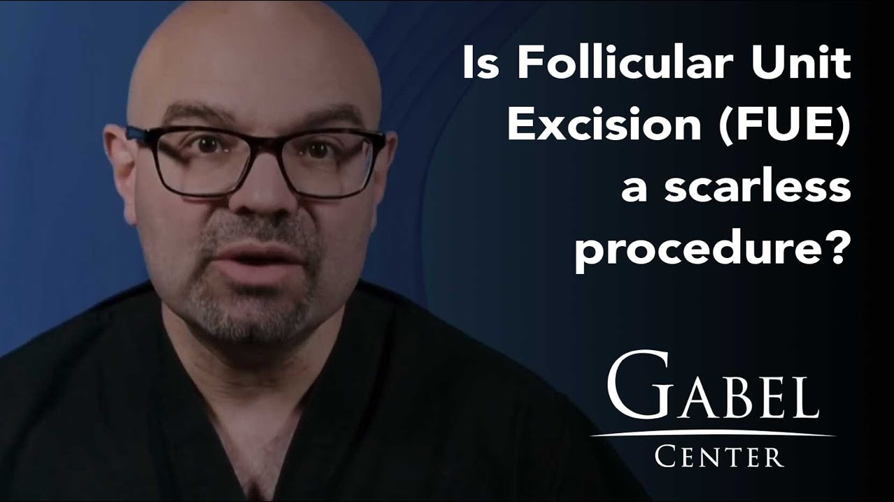 Is Follicular Unit Excision (FUE) a scarless procedure? | FAQ's with Dr. Gabel | Gabel Center