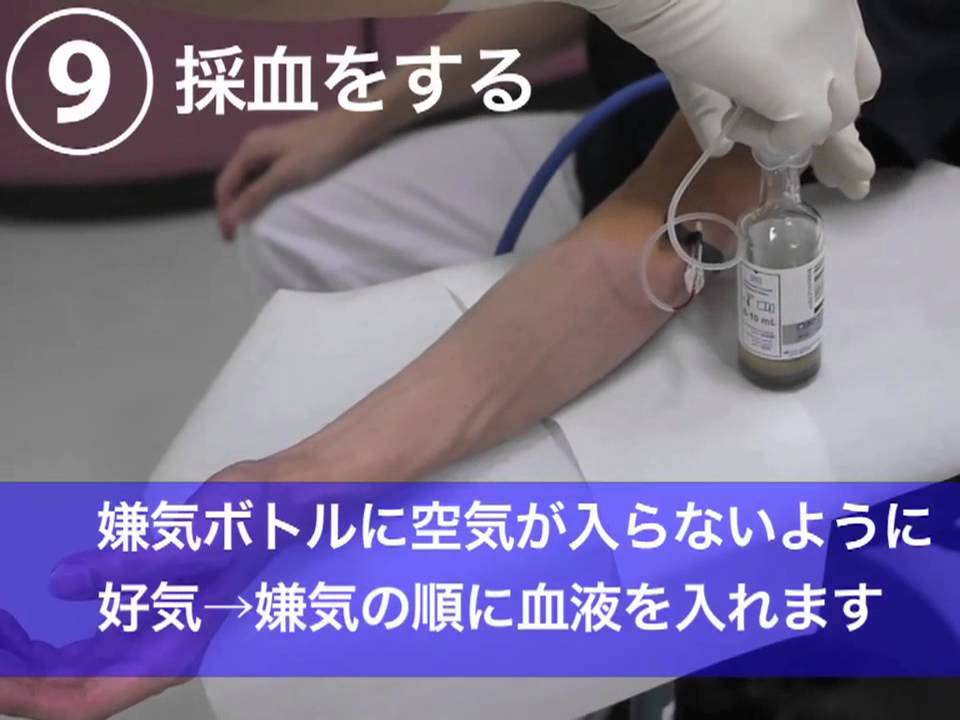 血液培養の採り方