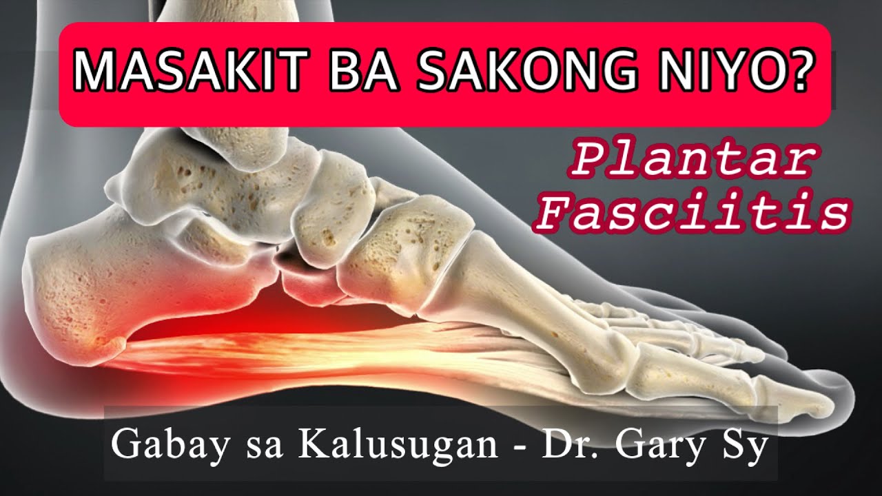 Plantar Fasciitis (Heel Pain) - Dr. Gary Sy
