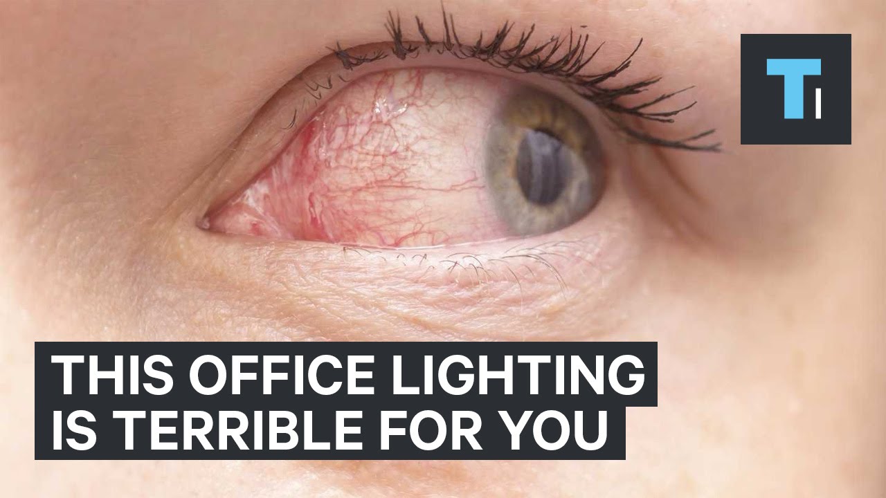 This office lighting is terrible for you