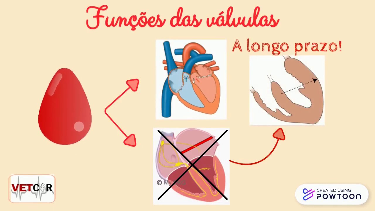 Endocardiose