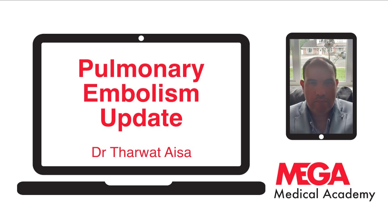 Pulmonary Embolism Update