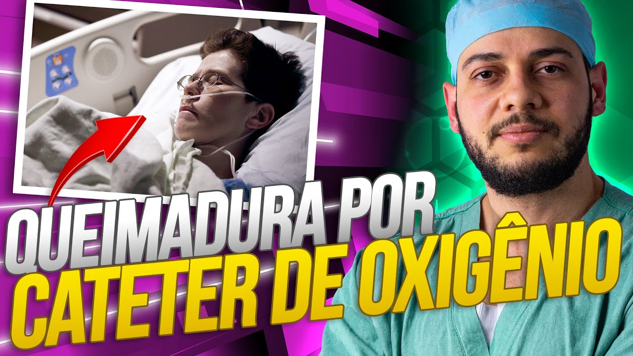 ALERTA pra quem indica cateter de oxigênio aos pacientes: queimaduras