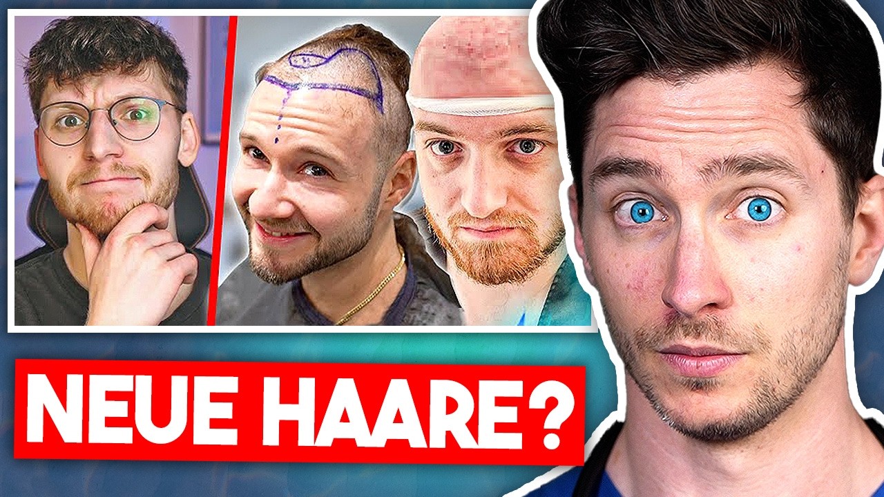 Haartransplantation - Neuer Trend ist gefährlich? (Reaction auf Klengan) | Doc Felix