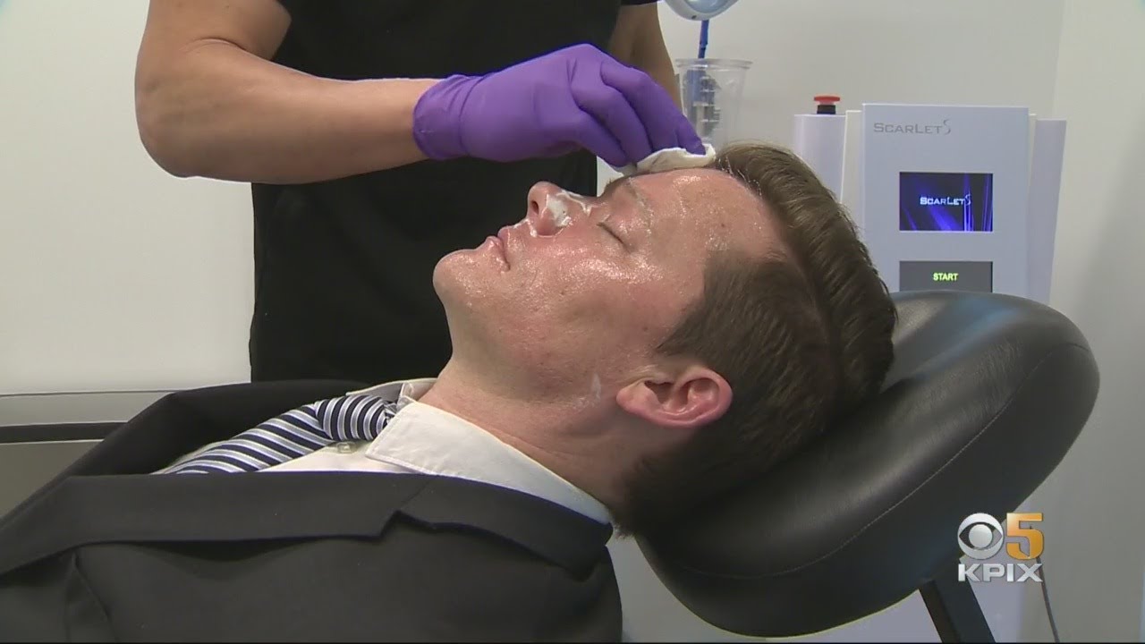 Ageism In Silicon Valley: More Men In Tech Getting Plastic Surgery To Combat Age Bias