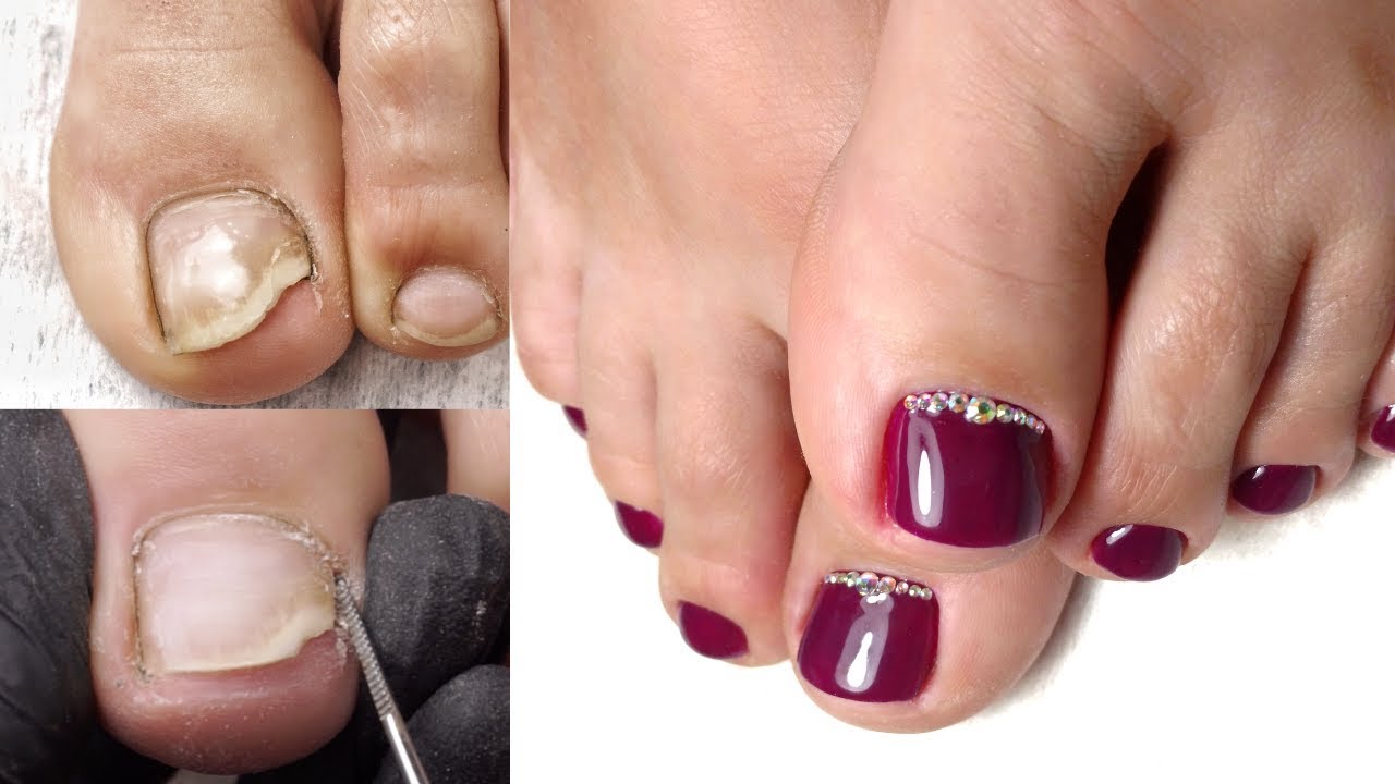 Summer Pedicure | Transformation | Hardware Pedicure