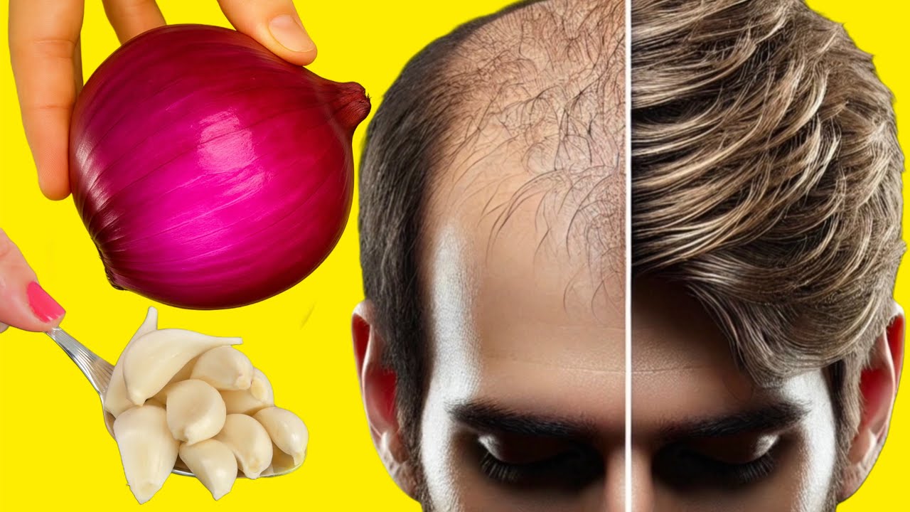 This Japanese Hair Trick with Onion & Garlic Changed My Hair