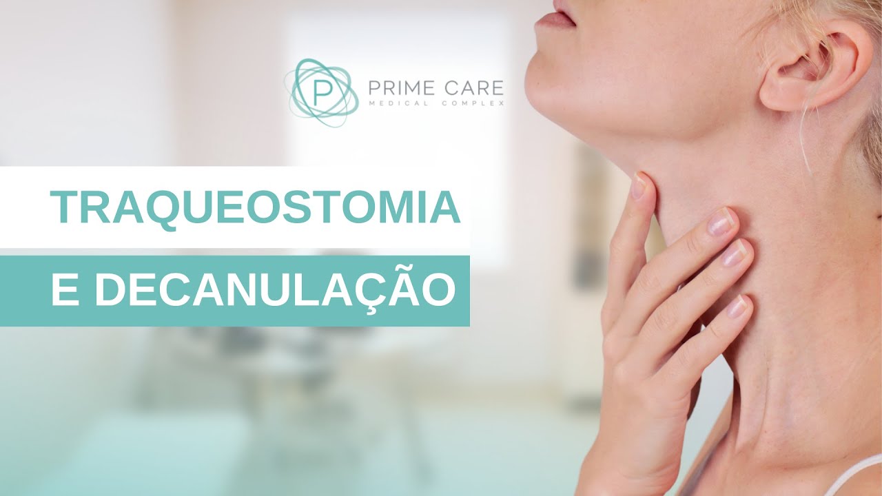Entenda sobre procedimento de Traqueostomia e decanulação de traqueostomia!