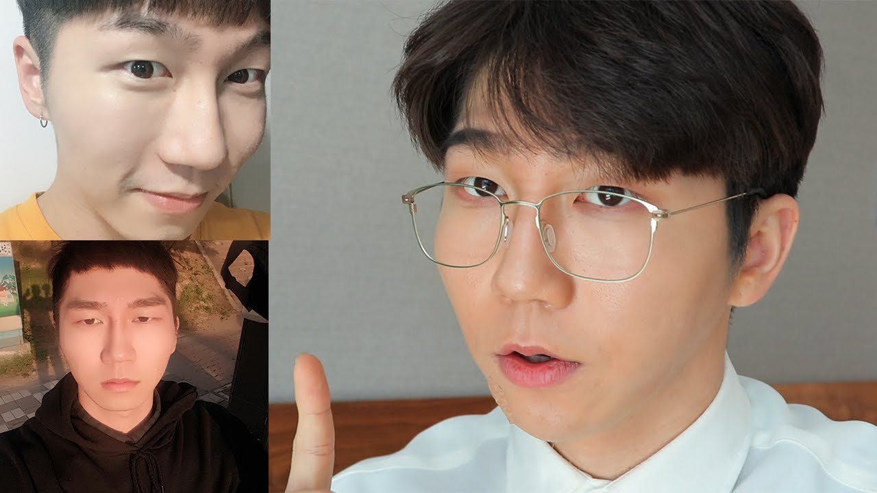 내가 코필러 2번 맞고 더 이상 안 맞는 이유. 코 퍼짐과 부작용 보여드립니다.