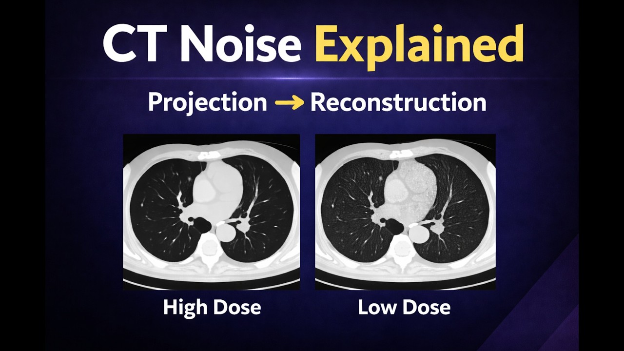 CT Noise Explained: From Photon Statistics to Reconstruction (Python Simulation)