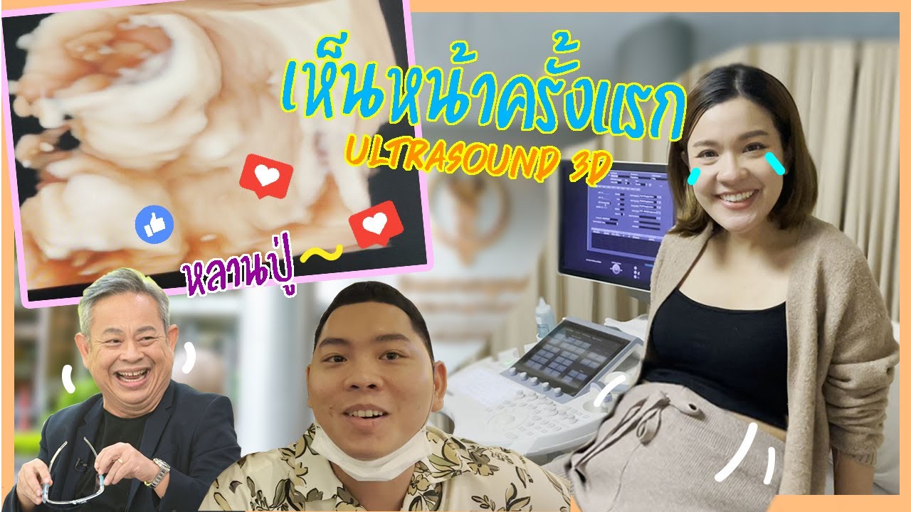 เผยหน้าลูกสาวครั้งแรก Ultrasound 3D - 5 เดือน