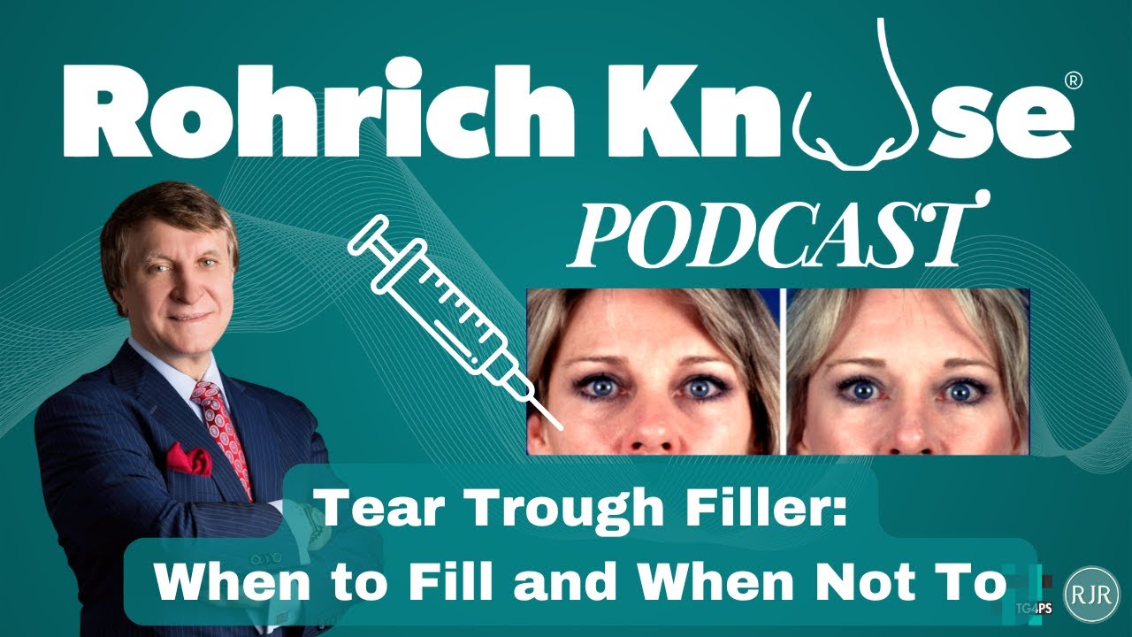 Tear Trough Filler- Should it ever be done!