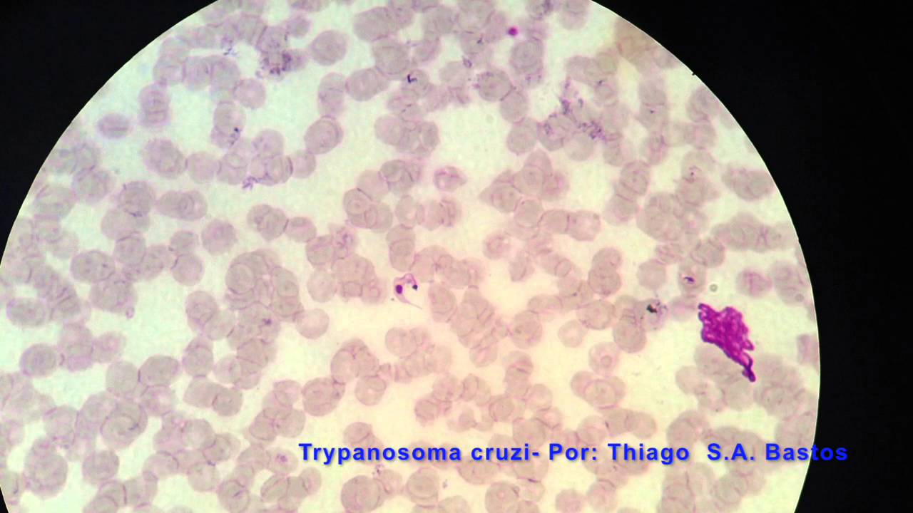Trypanosoma cruzi