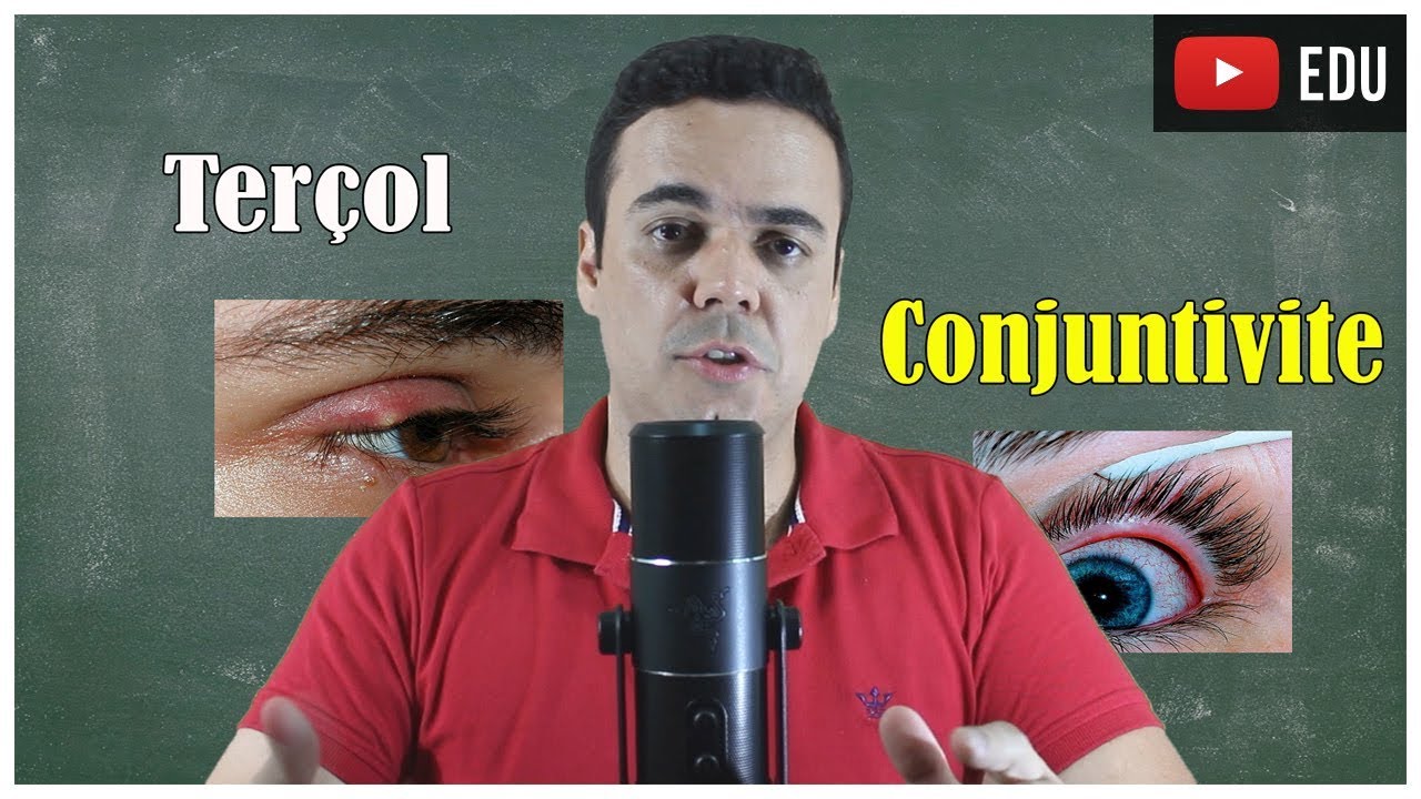 Terçol e Conjuntivite