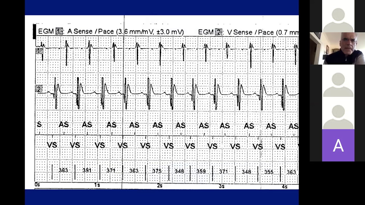 Orlov 5 14 20  Device EGM Cases