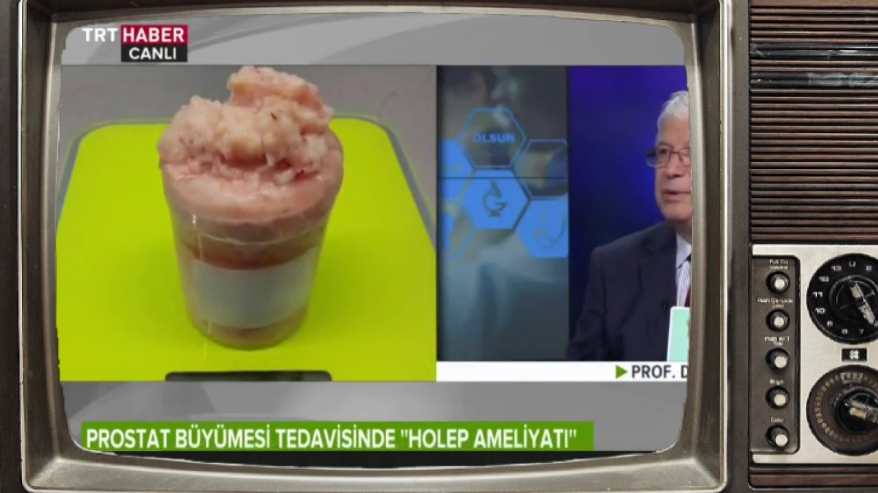 İyi Huylu Prostat Büyümesinde HoLEP Ameliyatı - Prof. Dr. Remzi Sağlam