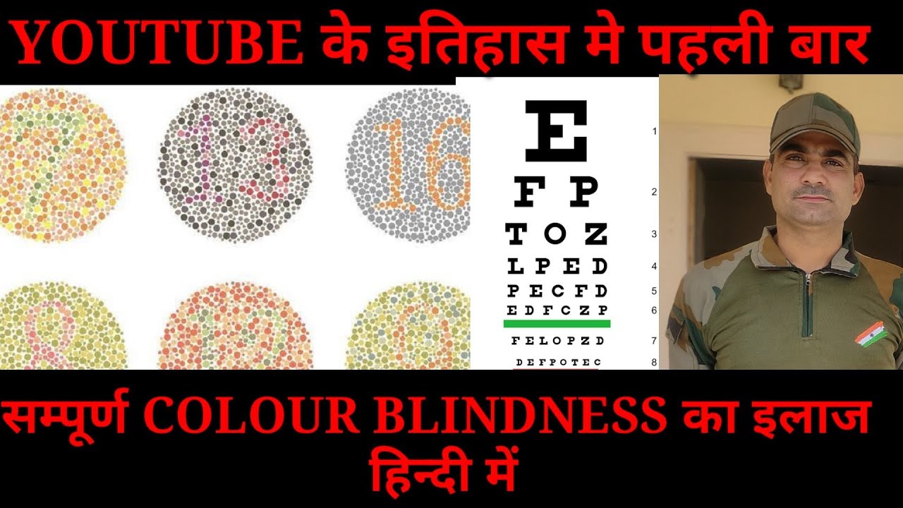 कलर ब्लाइंडनेस ठीक करें 2 month /correct color blandness in 2 month #colourblindness