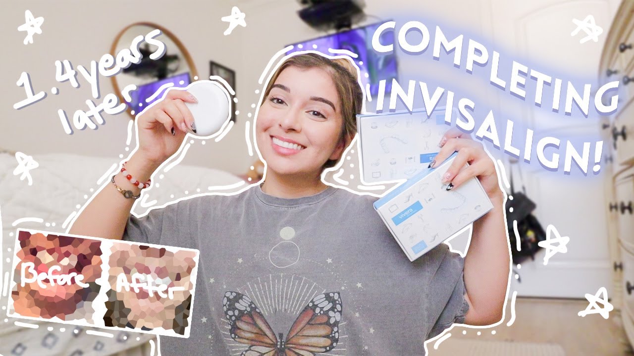 Finally Completing Invisalign! Before and After | + getting a crown!