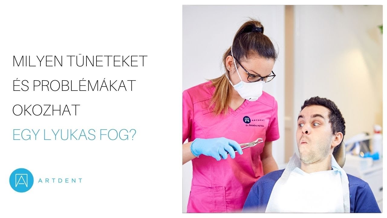 Milyen tüneteket és problémákat okozhat a lyukas fog?