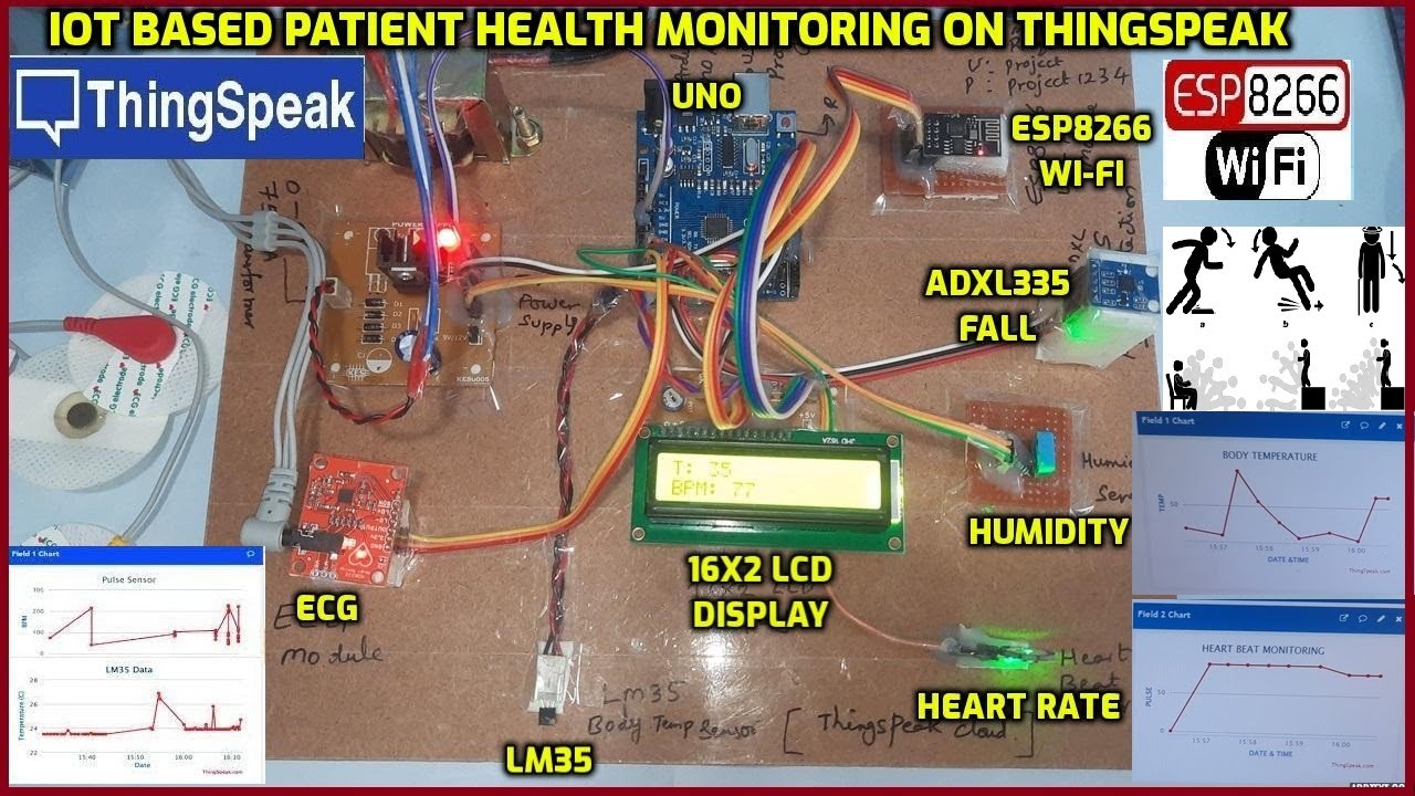 Мониторинг здоровья пациентов на базе Интернета вещей на ThingSpeak с использованием ESP8266 и Ar...