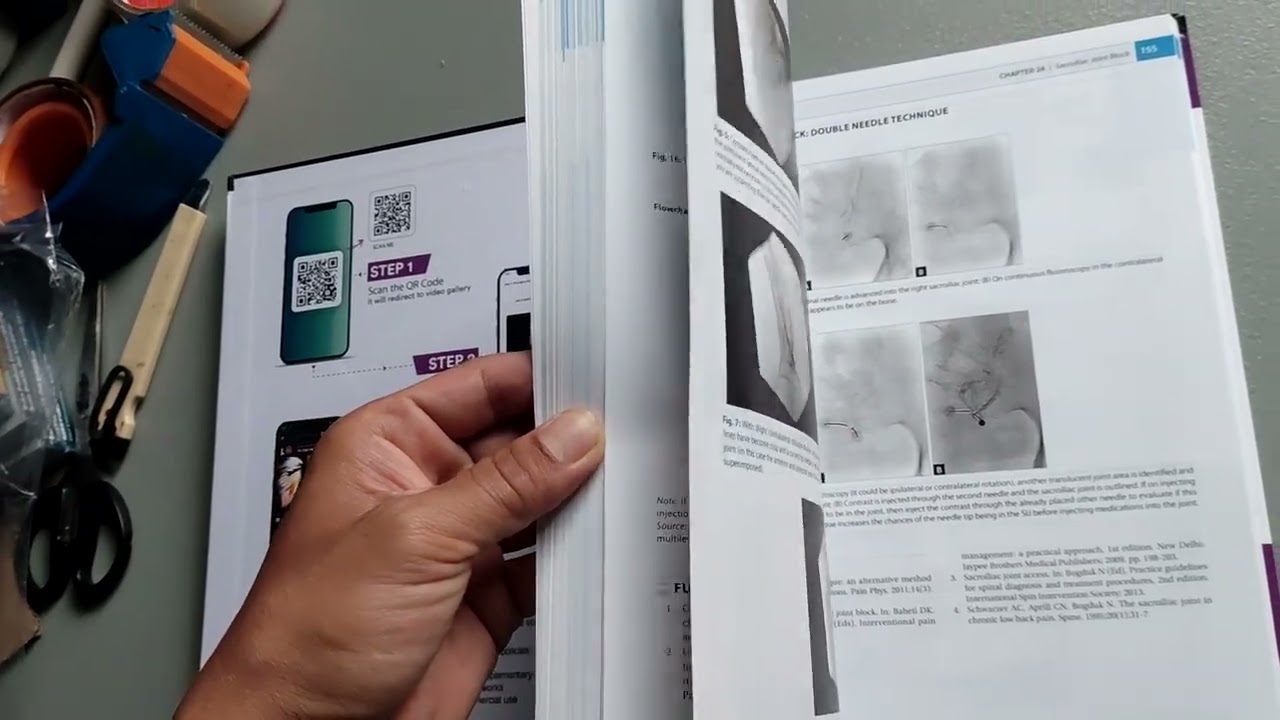 Atlas of Interventional by baheti