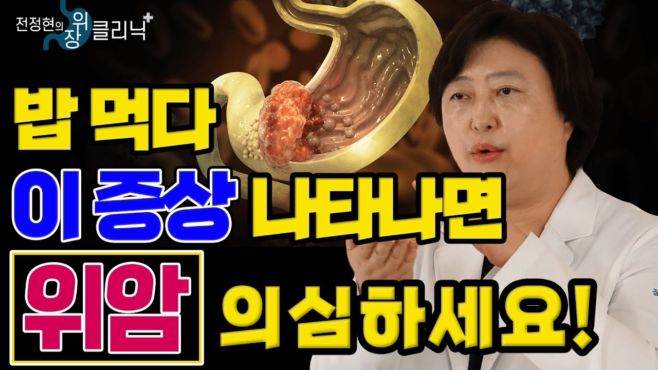 위암 경고 증상! &lsquo;이것&rsquo; 놓치면 위암 위험합니다! - 전정현의 위장 클리닉 #8ㅣ위암 전조증상 경고증상 헬리코박터 위암 수술법 위암 예방