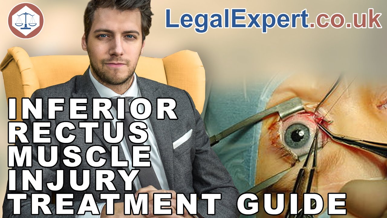 Inferior Rectus Muscle Injury Treatment Guide ( 2019 ) UK