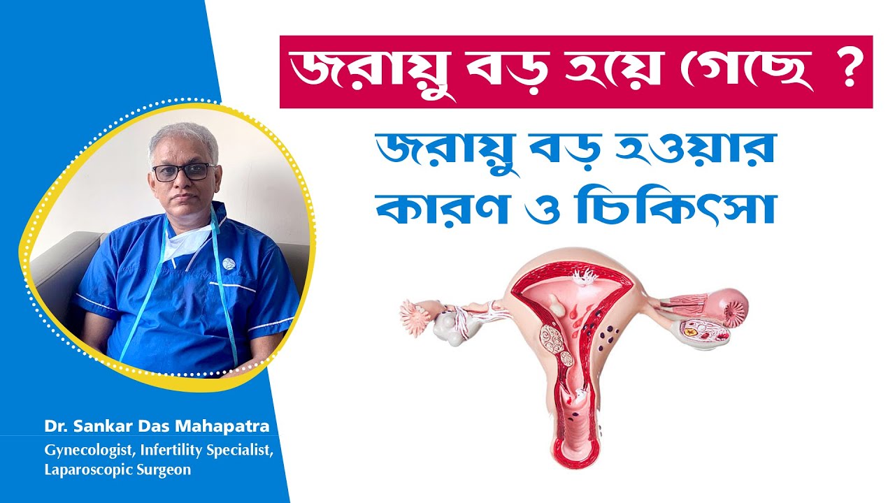Bulky Uterus | গর্ভাশয়ের মাপ কত হওয়া ভালো ? Dr Sankar Dasmahapatra Gynaecologist in kolkata