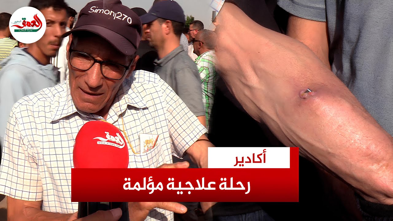 قصة مؤلمة.. مواطن يروي تفاصيل علاجه بمستشفى الحسن الثاني بأكادير