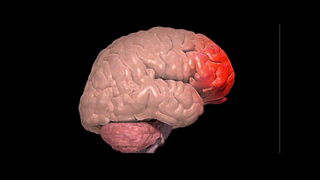 What is a Frontal Lobe Injury?